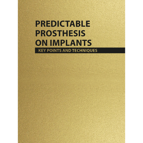 Predictable Prosthesis On Implants, Key points and techniques