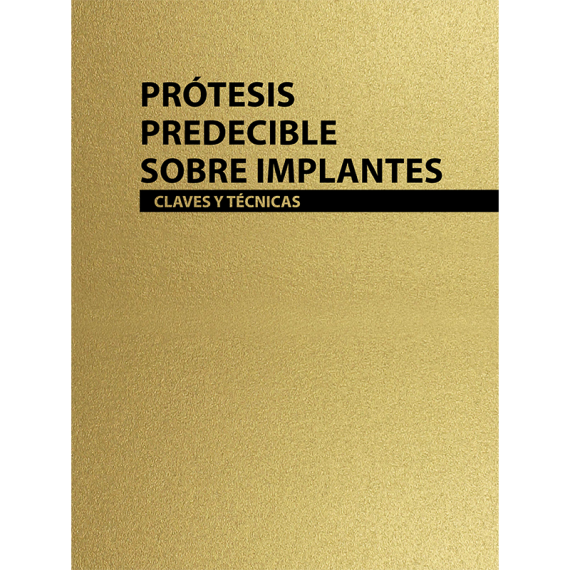 Prótesis predecible sobre implantes - Claves y técnicas