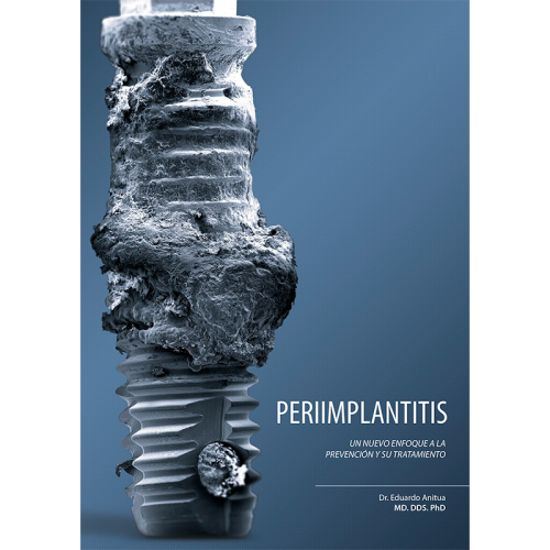 Peri-implantitis. Un nuevo enfoque a la prevención y su tratamiento