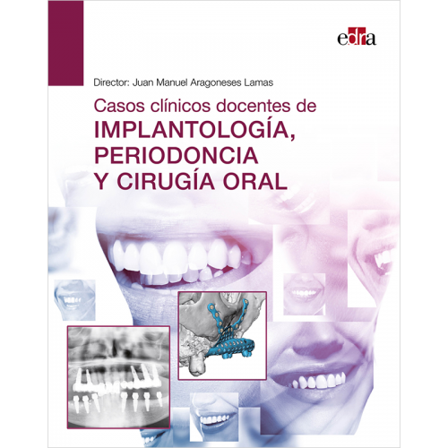 Casos clínicos docentes de implantología, periodoncia y cirugía oral