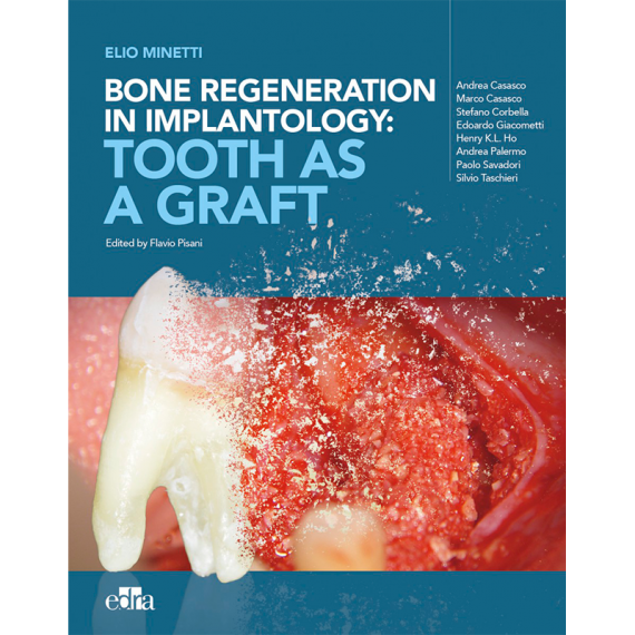 Bone regeneration in implantology:tooth as a graft