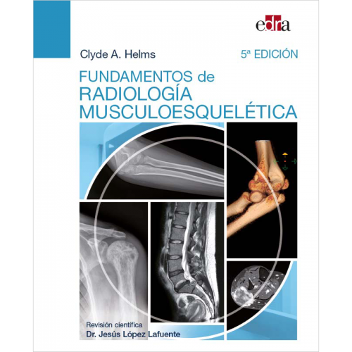 Fundamentos de radiología musculoesquelética